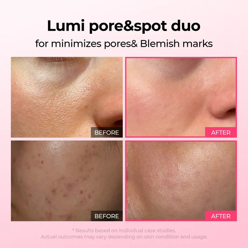 Lumi Pore & Spot Care Duo