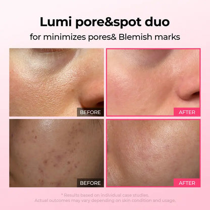 Lumi Pore & Spot Care Duo