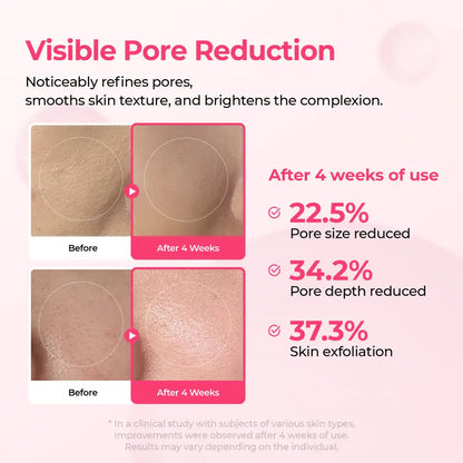 Lumi Pore & Spot Care Duo